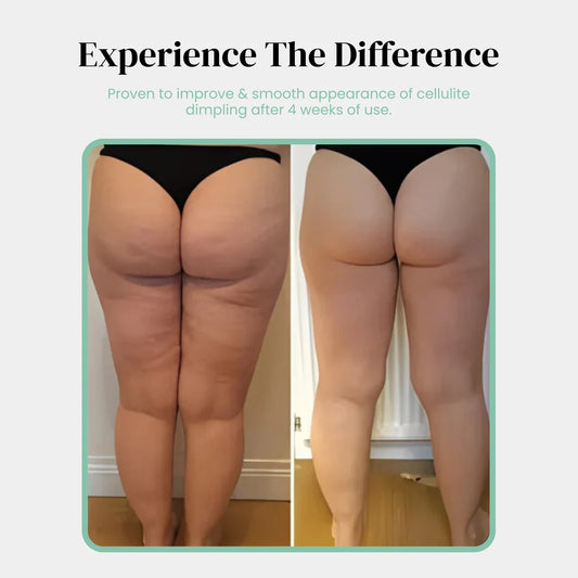 Celo Pro Cellulite Roller